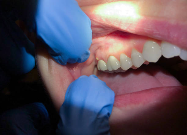 Best Cosmetic Emergency Dentistry in Lewiston, MN