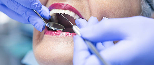 Best Emergency Dental Care for Broken or Chipped Teeth in Lewiston, MN